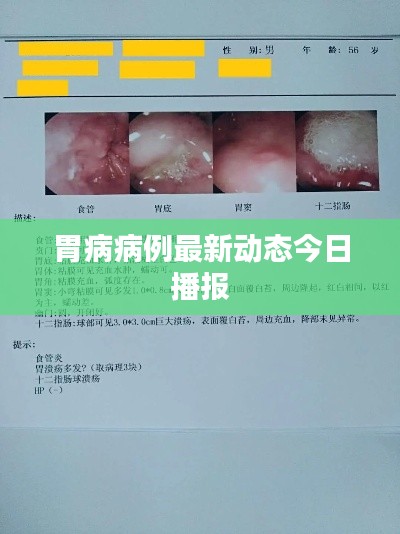 胃病病例最新动态今日播报